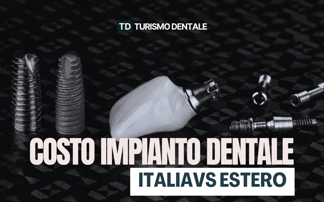 Quanto Costa un Impianto Dentale? Prezzi Italia ed Estero 2026