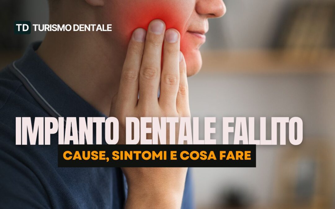 Impianto dentale fallito: cause, sintomi e cosa fare